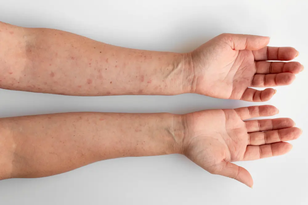 allergic reactions on hand